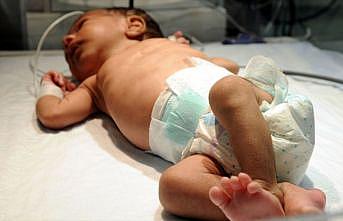 Her yıl yaklaşık 15 bin bebek doğumsal kalp hastalığıyla dünyaya geliyor