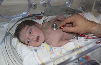 Kalp hastası Suriyeli Mahmut bebek Türkiye'de yaşama tutundu