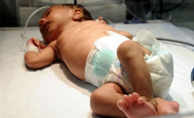 Her yıl yaklaşık 15 bin bebek doğumsal kalp hastalığıyla dünyaya geliyor