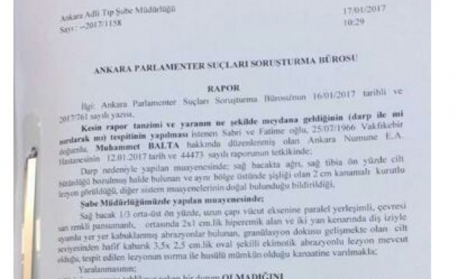 Adli Tıp ’AK Parti Trabzon Milletvekili ısırıldı’ dedi