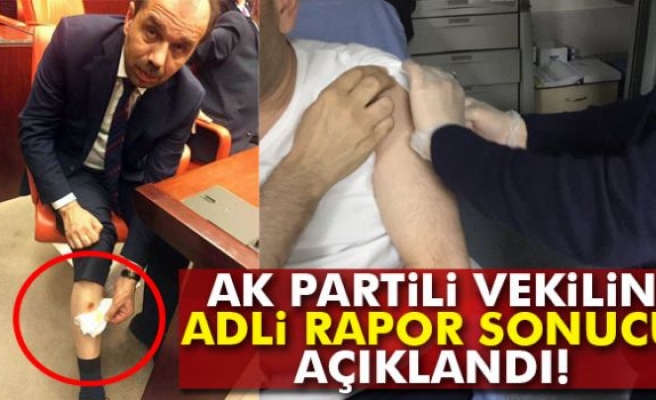 Adli Tıp 'AK Parti Trabzon Milletvekili ısırıldı' dedi