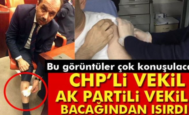 TBMM'de CHP Milletvekili, AK Partili Balta'yı bacağından ısırdı