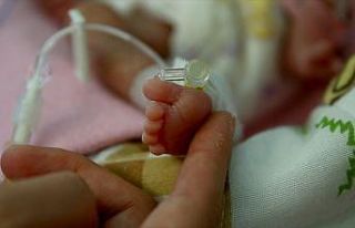 Dünyada her yıl 15 milyon bebek prematüre doğuyor