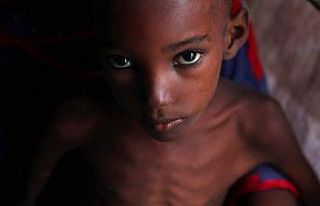 'Dünyada her gün 25 bin kişi açlıktan ölüyor'