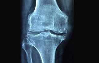 Romatizmal hastalıklar 'osteoporoz' riskini artırıyor